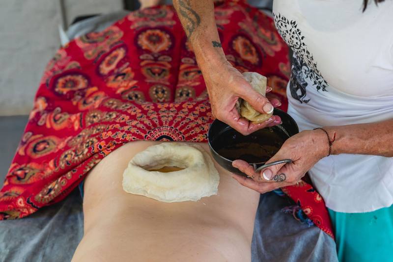 Treatments photo 137